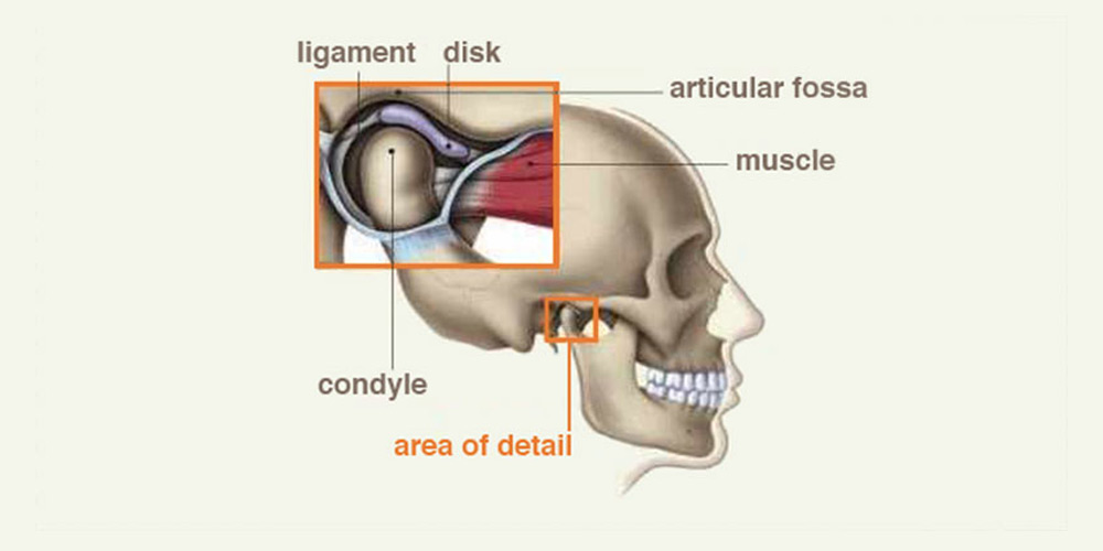 Disorder tmj Understanding Temporomandibular